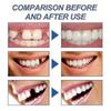 2024 New Strong Teeth Tooth Repair Permanent Dental Cement Cavity Filling Kit Fake Teeth - Ri