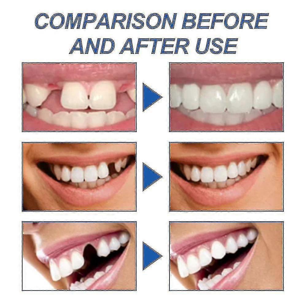 2024 New Strong Teeth Tooth Repair Permanent Dental Cement Cavity Filling Kit Fake Teeth - Ri