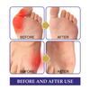 Пластырь для ухода за ногами, 5 шт./кор., эффективный, надежный, не раздражающий, безопасный, тонкая работа, снимает отек, нетканый материал, пластырь для ног против бурсита для дома