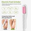 Electric Callus Remover for Feet, 2025 New Electric Feet Callus Scrubber Foot Care for Men Women