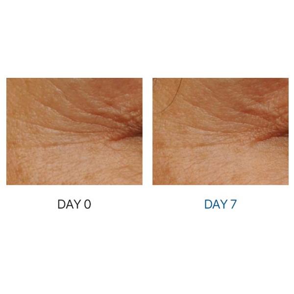 DERMA FACTORY Matrixyl 15% Сыворотка против морщин 30 мл