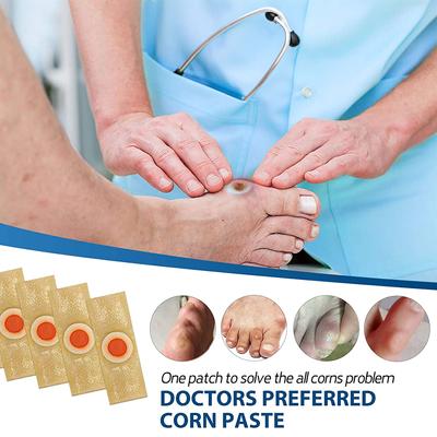 Удаление мозолей на ногах, подошвенных мозолей