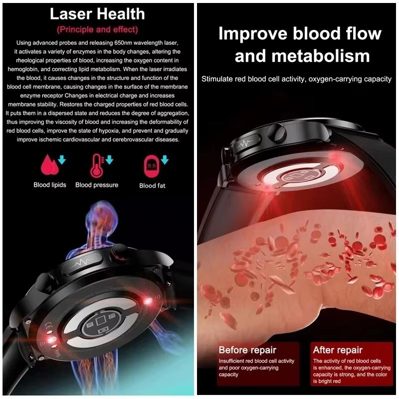 2025 New Non-Invasive Laser Treatment Three High Smart Watch Sapphire Screen Blood Fat Uric Acid ECG Health Diagnosis Smartwatch
