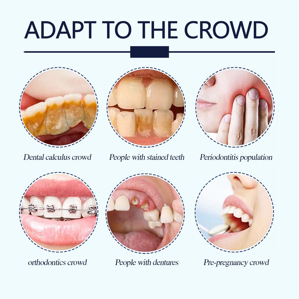 Восстановление зубов Минеральный порошок Отбеливание зубов Удаление пятен Чистота полости рта Свежее дыхание Улучшение запаха Уход за зубами Зубная паста