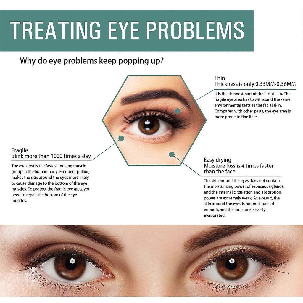 Limited time!!Eelhoe Anti-Aging Eye Serum Reduces Dark Circles, Eye Bags, And Wrinkles, Firms And Brightens The Eye Area, Evens Skin Tone