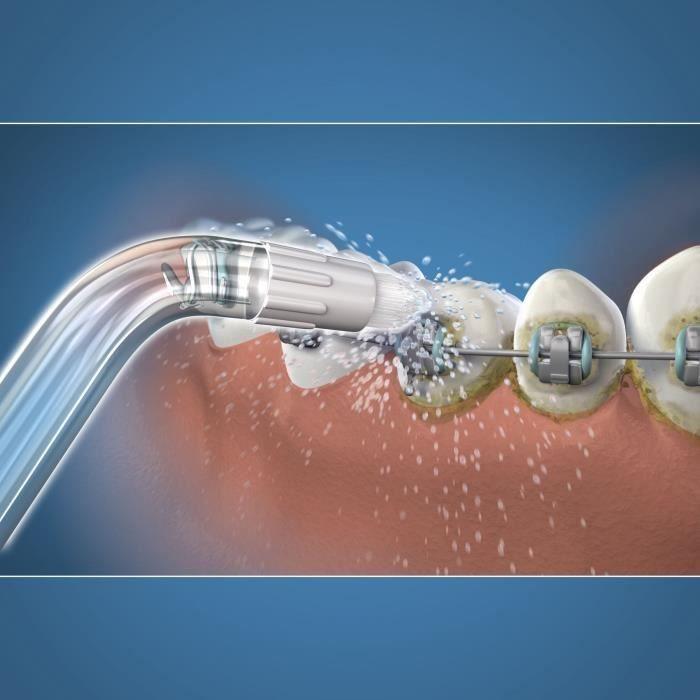 Embout Hydropulseur - WATERPIK - Orthodontique - Élimine la plaque - Spécial appareils dentaires