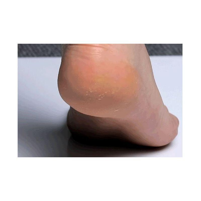 MEDIPEEL - Увлажняющий крем-пилинг для ног с EGF
