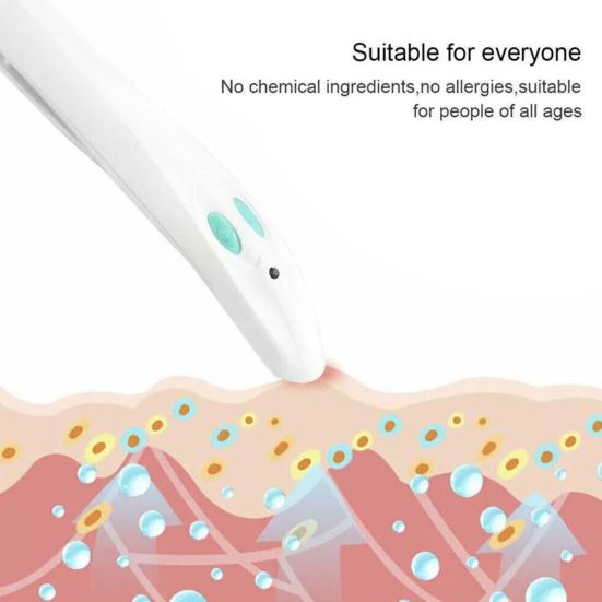 Электронное устройство для снятия зуда от укусов, работающее от батареек, портативное, для детей и взрослых, тепловой импульс, зуд