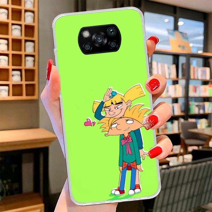 Мультяшный Хей Арнольд Фонс Чехол для телефона Для Xiaomi Poco F7 Ultra X7 X6 X5 Pro M7 Redmi 15C 15 13C 13 12C 12 10C 10 9A 9C 9T 9