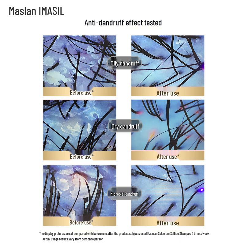 MASIL Шампунь с дисульфидом селена против перхоти и для контроля жирности