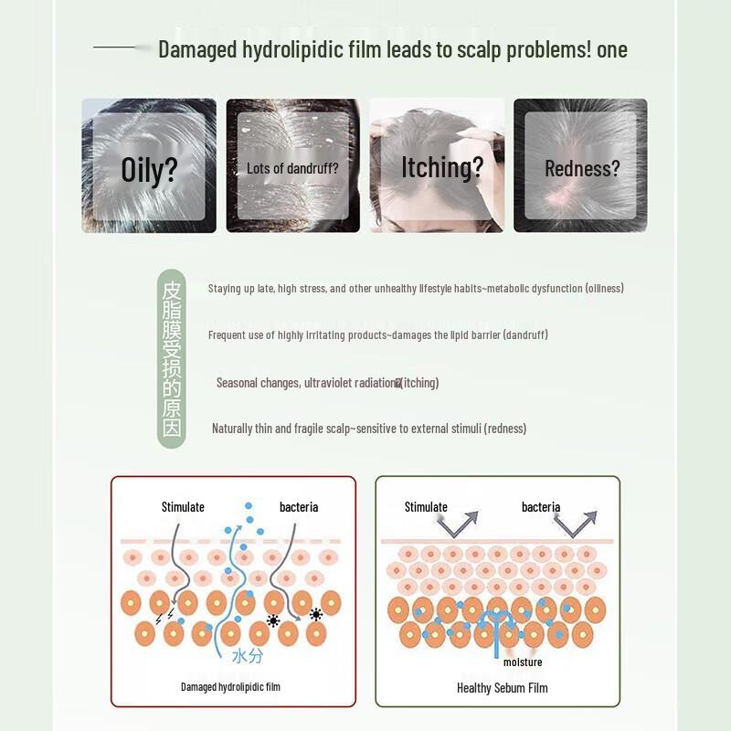 SLEK Oil Control Anti-Dandruff Shampoo