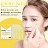 200 PCS Acne Patch For Face Pimple Patches For Face Acne Patches Hydrocolloid Acne Pimple Patch For Covering Zits And Blemishes Stickers