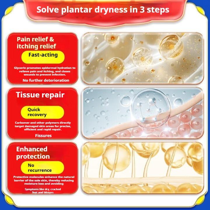 Специальный крем от трещин на руках и ногах, сухости и трещин на пятках, сухости и трещин, грибковой инфекции, трещин от обморожения