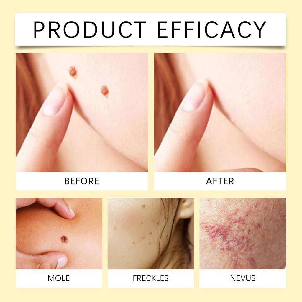 Крем для ухода за кожей Мягко очищает и увлажняет невусы и успокаивает крем для ухода за кожей