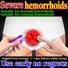Крем для облегчения геморроя - Натуральная травяная смесь, нежная для чувствительной кожи