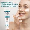 Whitening Cream Remove Dark Spots Diminish Pigmentation Freckle Removal Age Melasma Fade Acne Skin Care