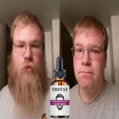 100% натуральное масло для роста бороды, эфирные масла, восстановление лица, глубокое увлажнение, питание для любой кожи, инструменты для ухода за бородой