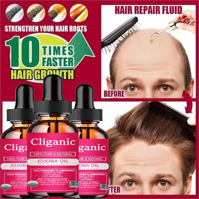 Сыворотка для роста волос, масло, быстрый густой натуральный уход за волосами, восстановление кожи головы, предотвращение выпадения волос, средства для восстановления поврежденных волос