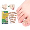 Ingrown Toenail Sticker Waterproof Ingrown Toenail Corrector Strips Breathable Reduce Pain Recover Corrector Pedicure Tool