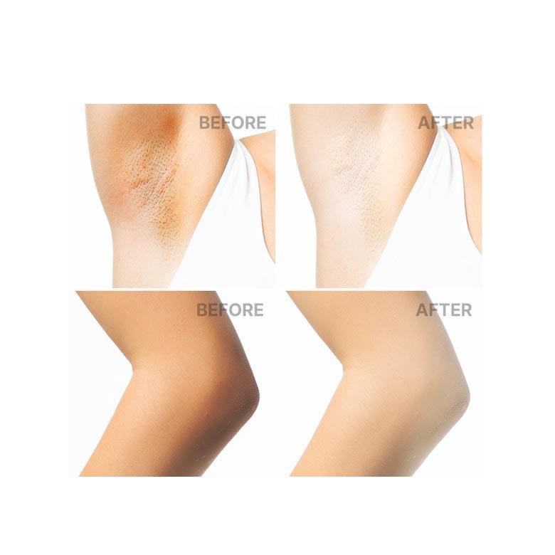 Крем для сосков FOELLIE Virgin 30 мл