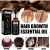 West&Month Hair Growth Essential Oil, Dense Hair Growth Repair Dry Hair And Moisture Hair Essence