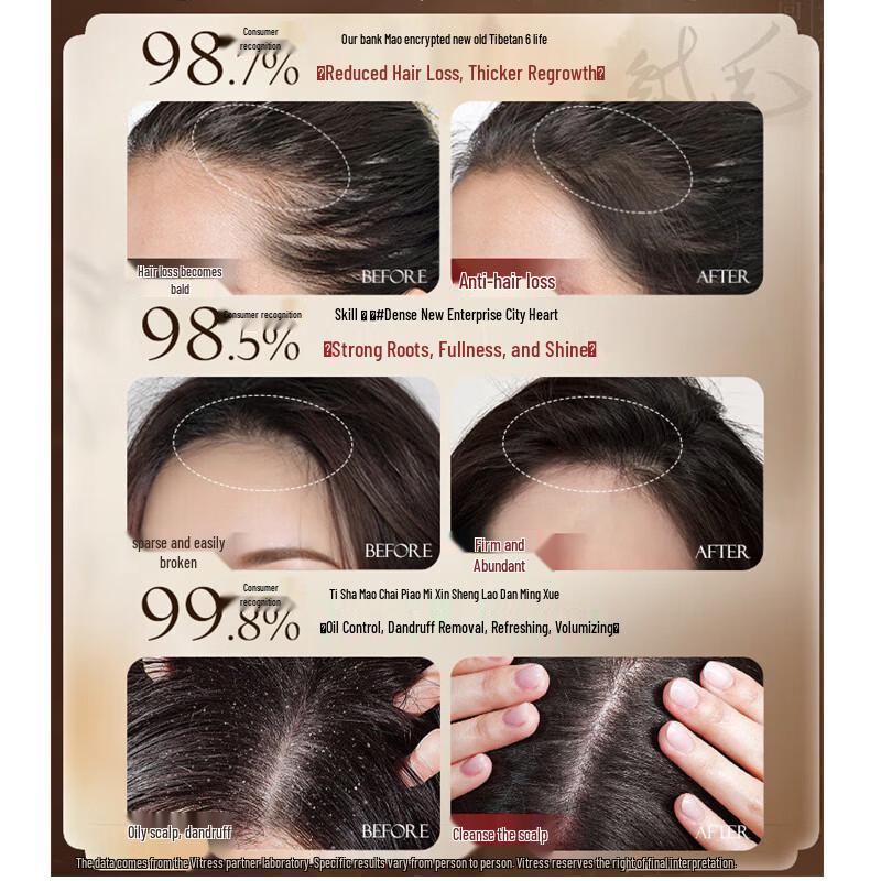 Vitess Ginger Anti-Hair Loss Strengthening Shampoo