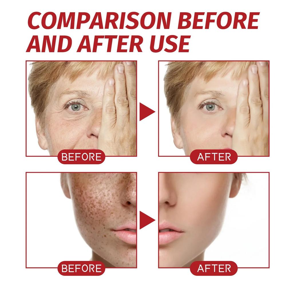 Крем для удаления морщин, против старения, выцветания, тонких линий, укрепляющий лифтинг, выцветания кожи, темных пятен, лечения веснушек и меланина, восстанавливающий крем для лица