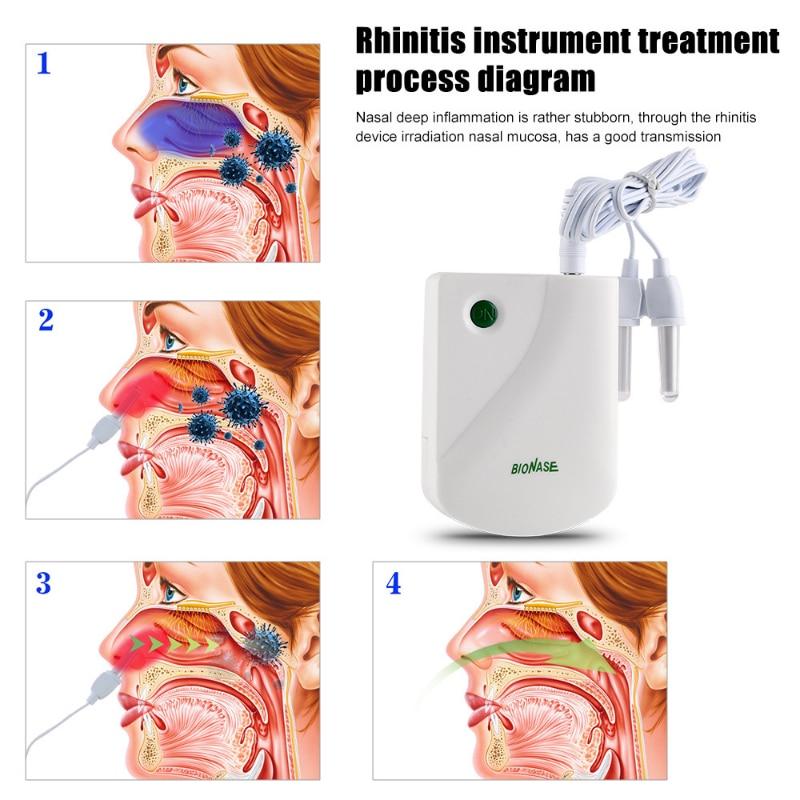 Rhi Nitis Sin Usit Is Nose Health Cure Therapy Machine Уход за носом Rh in itis Устройство для бионазного массажа Лазерное лечение Массажер для носа Здравоохранение