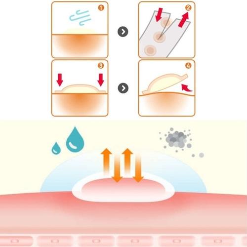 CARE ZONE Cover & Cure Anti-blemish Patches 60ea*2Set