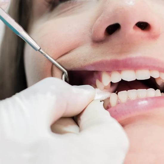 Стоматологическая нетканая марля ET