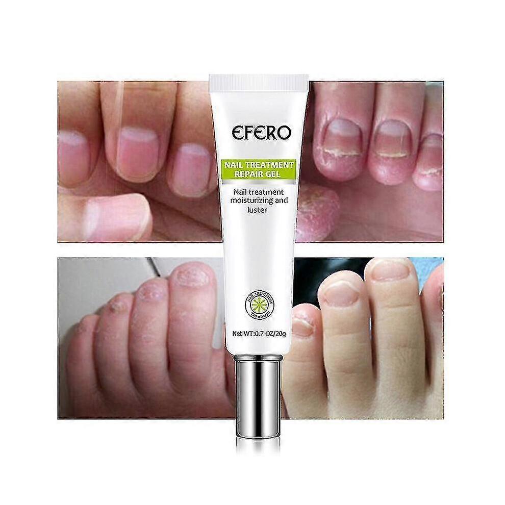 3x Efero Nail Exfoliation Plant Nail Repair Fluid Nail Cream Nail Treatment Gel Nail Repair Gel Moisturizing Nail Luster Tw