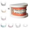 1 Pair Colorful Orthodontic Ligature Ties Dental Decorations Metal Bracket  Teeth