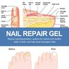 20 г гель для лечения ногтей, укрепляющий, украшающий, долговечный, удобный для пользователя, эффективный гель для ремонта маникюра