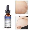 5ML/15ML/30ML/50ML/Abdominal Massage Oil for Removing Stretch Marks, Moisturizing and Hydrating Massage Oil