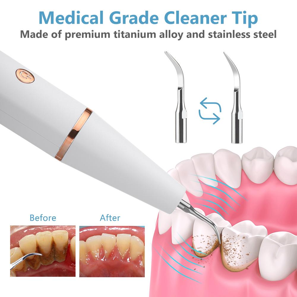 Ультразвуковой стоматологический скалер, очиститель пятен от зубного камня, отбеливание зубов, чистка, бытовой очиститель от зубного камня, пятен, пятен, со светодиодом