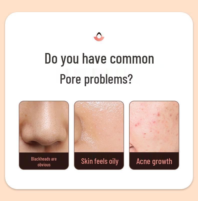 Ультразвуковой скрабер для кожи и удалитель черных точек: Косметологический прибор для пор лица, вакуумной чистки от черных точек и пилинга кожи.