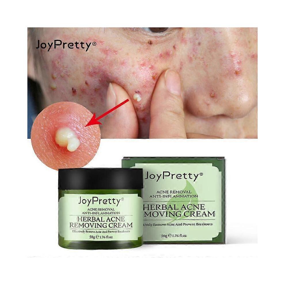 3 шт. JoyPretty Травяной крем для лица от акне Удаление прыщей Лечение акне Против акне Увлажняющий Восстанавливающий Поврежденную кожу Уход за кожей
