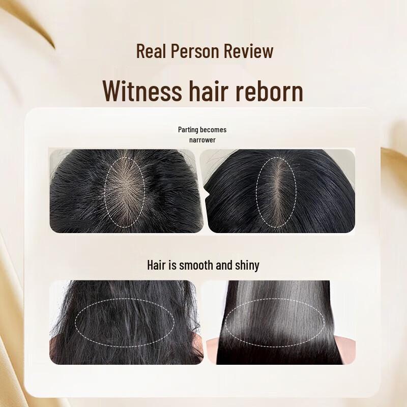 Bawang Anti-Hair Loss & Oil Control Shampoo