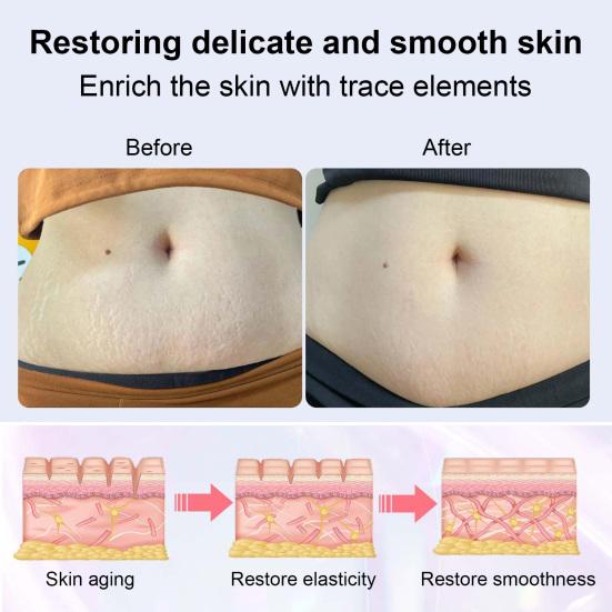 Электрический нефритовый массажер для удаления растяжек и целлюлита для живота, рук, талии, ног, 4 режима, портативное косметическое устройство для упругой и эластичной кожи, способствующее облегчению