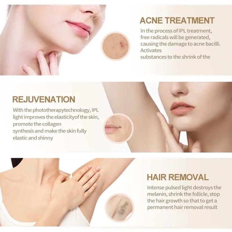 Лазерная эпиляция Vancostar 999900 Flash Cool, омоложение, лечение прыщей для дома, триммер для бикини, IPL-эпилятор, косметическое устройство