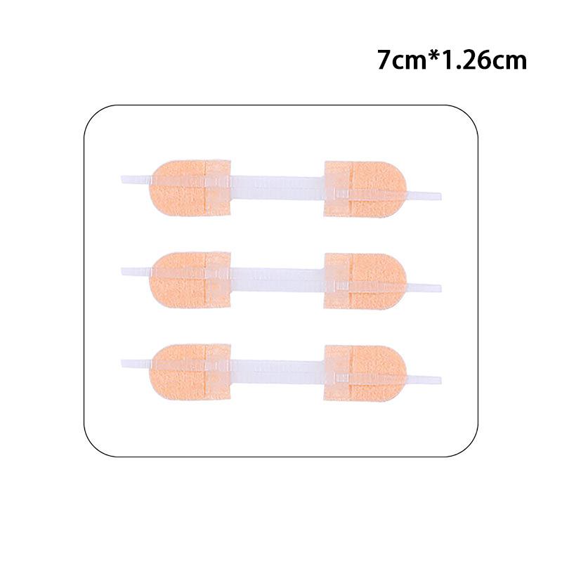Застежка-молния Заплатка для закрытия раны Гемостатическая заплата для быстрого шва на ране Лента на молнии