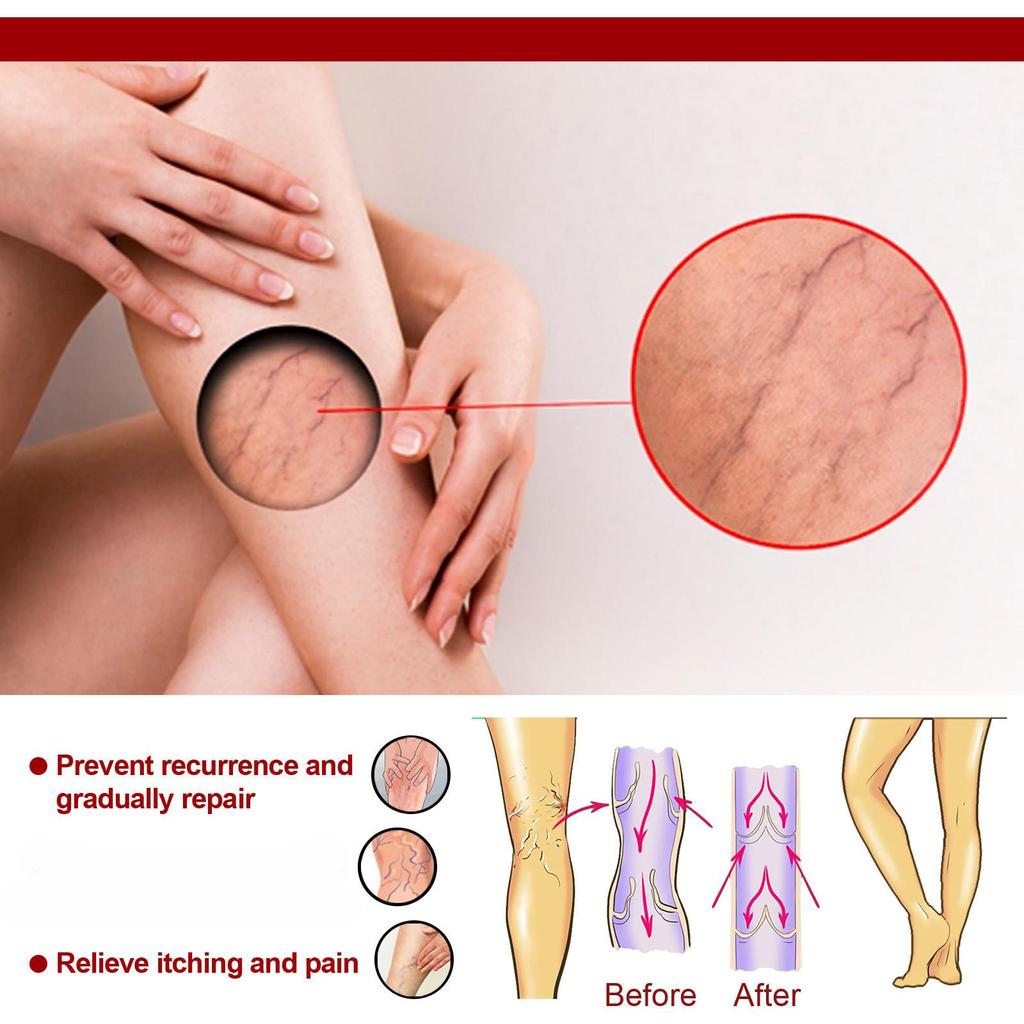 Крем для нормализации цвета кожи на ногах - 1 шт.