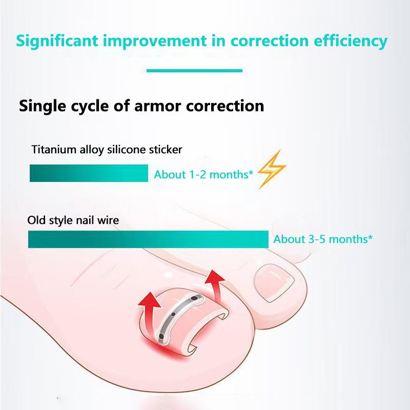 2 шт. корректор для вросшего ногтя педикюр восстановление вставка ногтя профессиональный зажим для выпрямления вросшего ногтя скоба