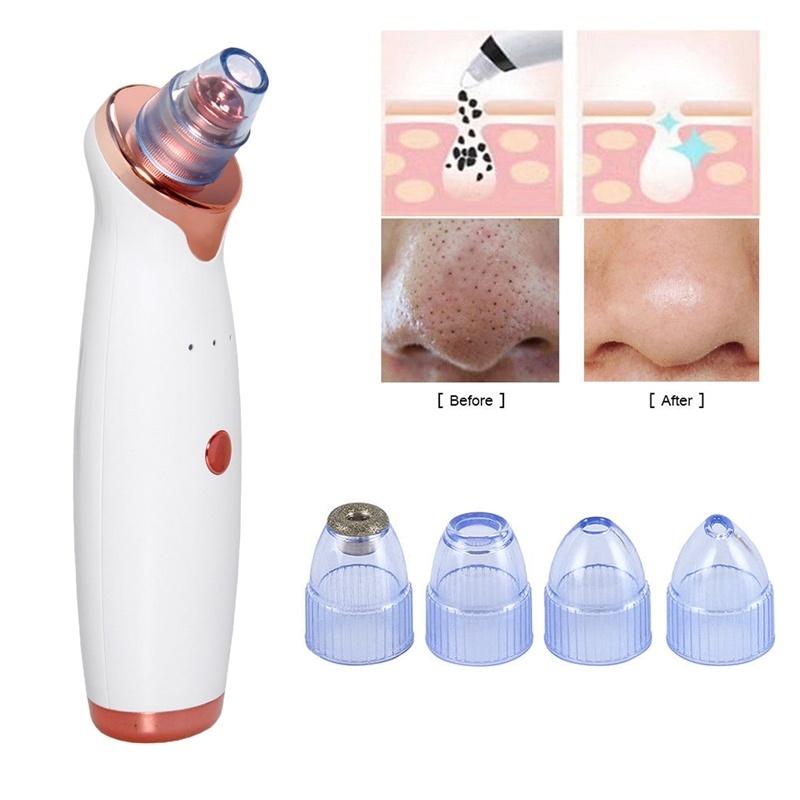 Вакуумный электрический пылесос для удаления черных точек, электрический нос, красота, лицо, глубокое очищение, уход за кожей, вакуумный пылесос для черных пятен, акне, очиститель пор, инструмент для прыщей