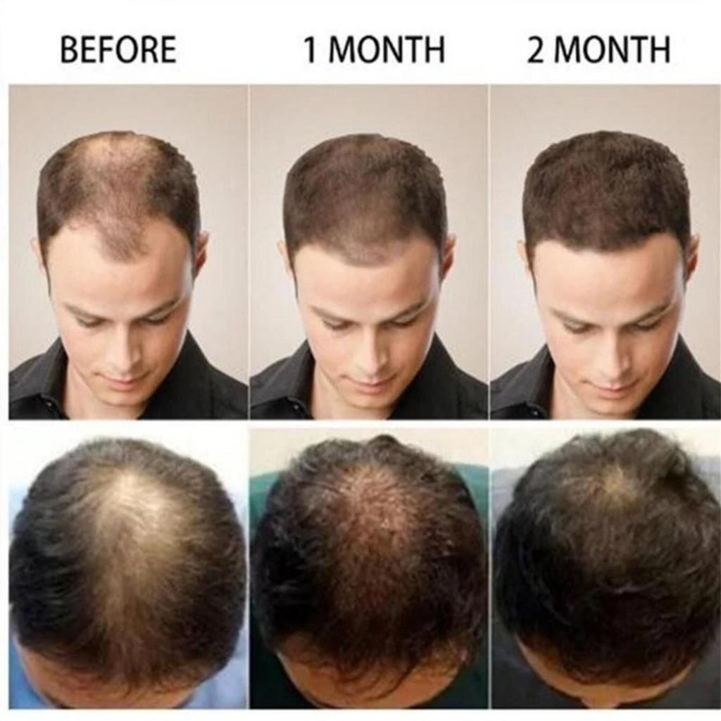 Сыворотка для роста волос, масло, быстрый густой натуральный уход за волосами, восстановление кожи головы, предотвращение выпадения волос, средства для восстановления поврежденных волос