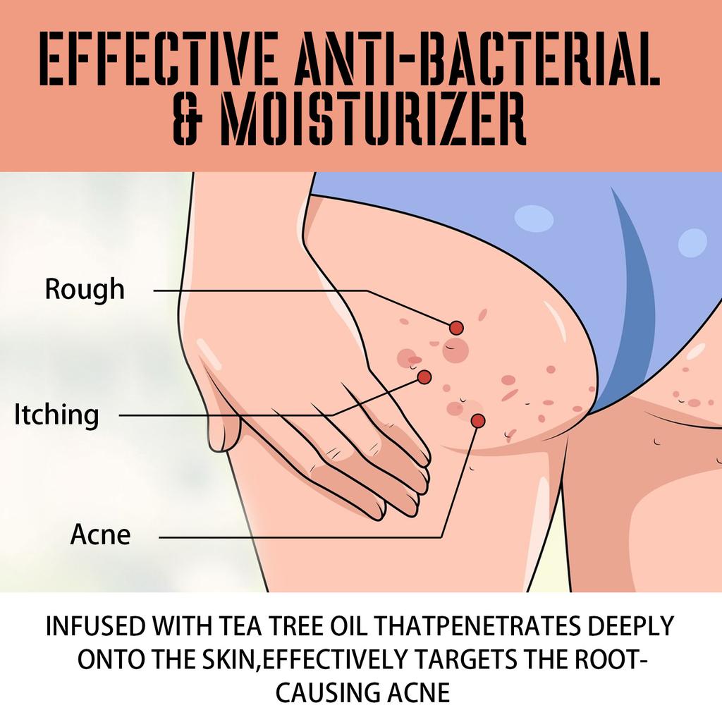 2023 Skin Care Body Fashion Care Health Hip Care Cream Relieves Rough and Itchy Buttocks Gently Nourishes and Moisturizes The Skin