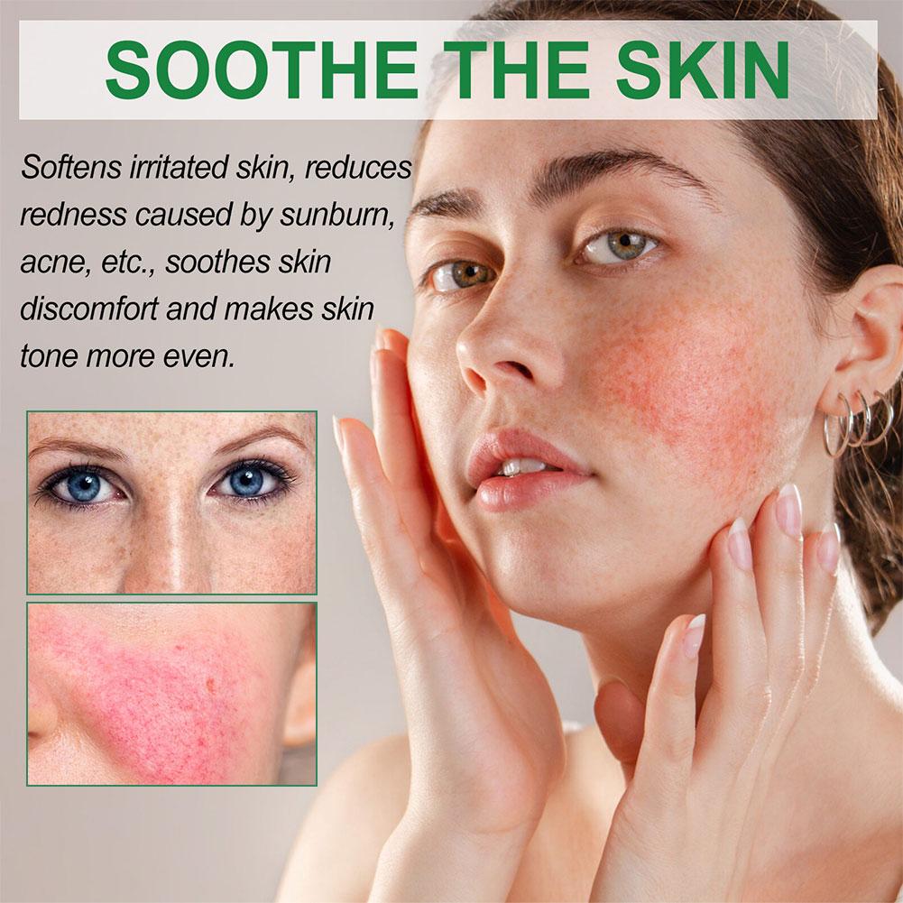 Увлажняющий крем для устранения покраснений, исчезновения пятен от прыщей, крем для кожи после отбеливания, уход за кожей, восстановление F F3B2
