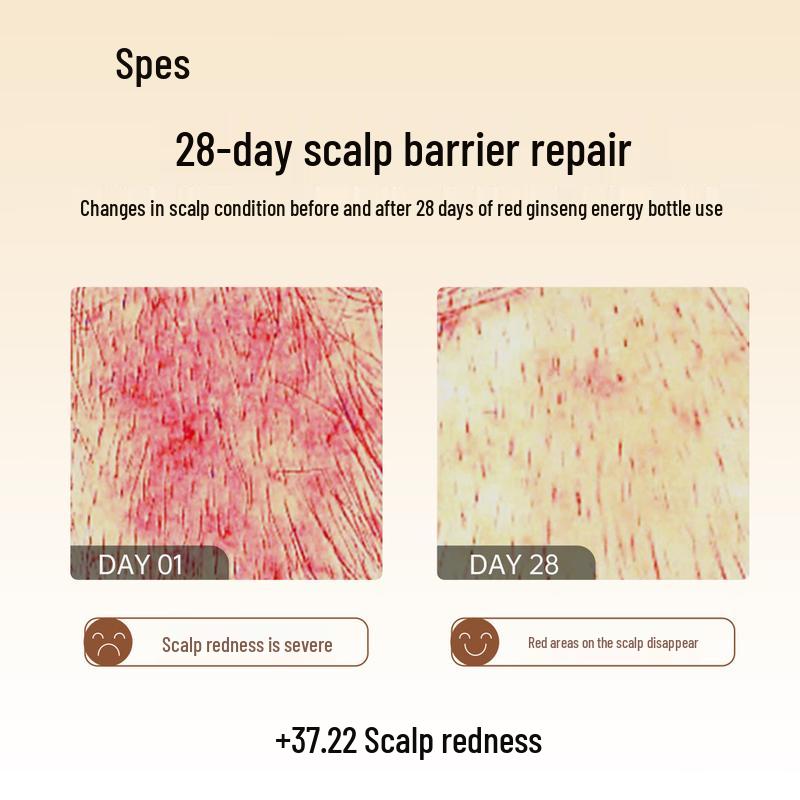 Spes Red Ginseng Oil Control Anti-Dandruff Hair Care Gift Set