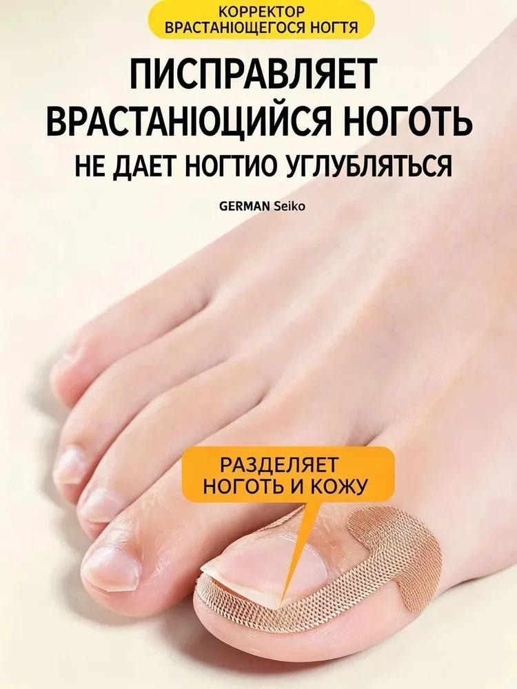 Set for the correction of ingrown nail, tools for correcting ingrown nails on the toes