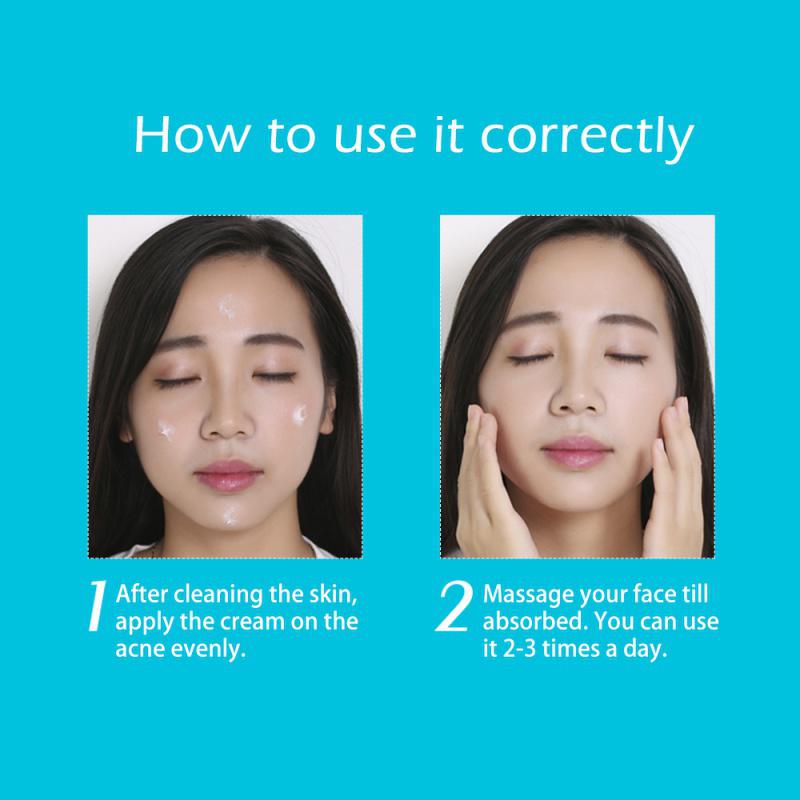 Крем для лечения прыщей, увлажняющее масло для контроля, сужение пор, удаление следов, средство для удаления прыщей